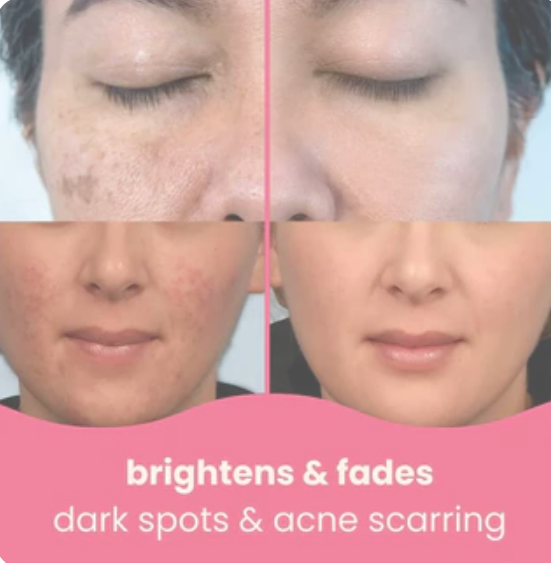 Turmeric Kojic Acid Cleansing Pads